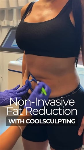 Freeze stubborn fat for less ❄️✨ For a limited time, CoolSculpting is...