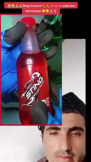 #sting Vs#worms🪱🪱🐛🐛😱😱😭😭🙏🙏🙏👈👈#newyorkcity🇺🇲🇺🇲🇺🇲 #tiktokforyou #foryoupage #like #tiktok#🔬🔬🔬🇺🇲🇺🇲🇺🇲🇺🇲😱😱😱🤔🤔🙏🙏🙏🙏👈👈👈میں