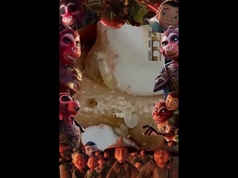 Blackheads Removal | Acne Treatment and Very Satisfying Satisfying Pimple pop #blackheads