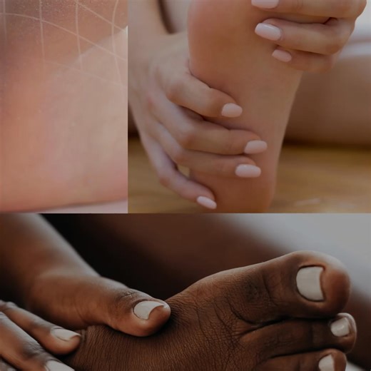 Visible results in 3 Days! With 22% Urea and Salicylic Acid. Helps to break down hard skin. Available at Boots! | Flexitol UK | Facebook