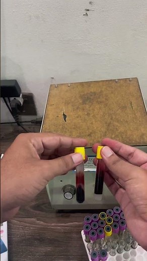 how to centrifuge the Blood Samples sample ? #viralvideo #science #medlab #facts