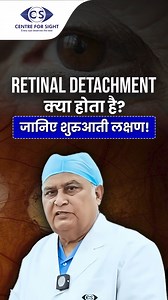 Retinal Tear vs Retinal Detachment: Early Warning Signs You Shouldn’t Ignore | Dr. Kamaljeet Singh A retinal tear or detachment can lead to permanent vision loss if not treated promptly. In this informative video, Dr. Kamaljeet Singh from Centre For Sight explains what these serious retinal conditions are, what causes them, and how to recognize early warning signs like sudden flashes of light, floaters, or a shadow over your vision. Early detection is critical to protect your eyesight. Don’t ign