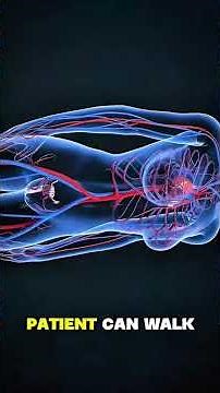 Vaginal pessary ring insertion 3d animations.Educational video for public and young trainees.#3d