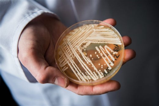 Texas seeing largest number of cases of deadly fungus in the country