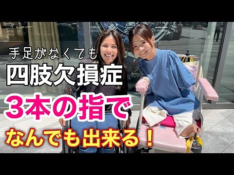 She has congenital limb defects and is missing both hands and feet. how do you live