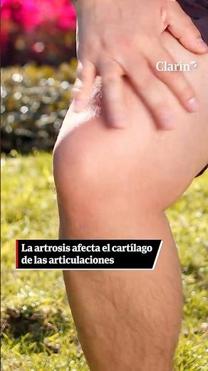 Cómo prevenir la artrosis: los hábitos que ayudan a cuidar las articulaciones con los años