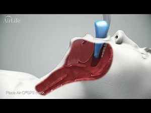 AirLife Air-Qsp3 Inservice Video (ANI-20027-C1)