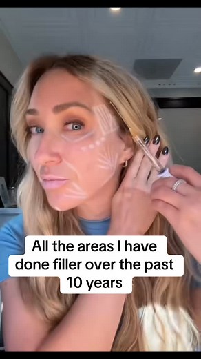 Approaching 48 and no regrets! I have about 7 syringes of dermal filler in my face currently. I started getting filler in my mid 30s and love the confidence it gives me! When dermal filler is done with skill the results can look amazing and natural. #filler #over40 #agegracefully #antiaging #fillermigration | Lipsandlattes