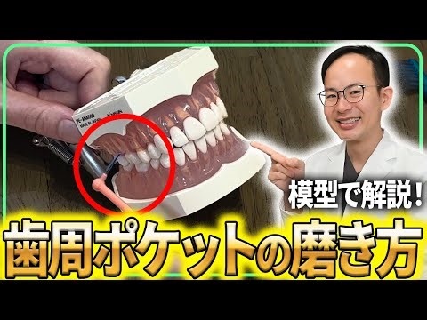 Learn how to brush your periodontal pockets in just 10 minutes! Dentists and dental hygienists wi...