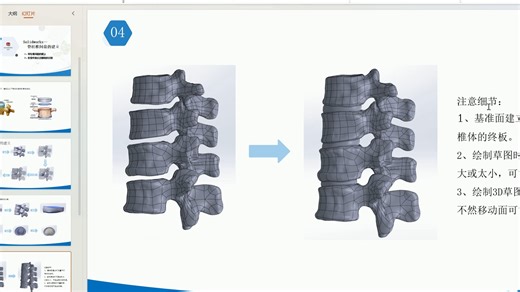 soldiworks建立脊柱关节突软骨并将椎间盘细分为上下终板、纤维环、髓核