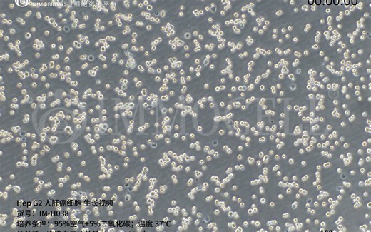 Hep G2人肝癌细胞形态,Hep G2细胞培养