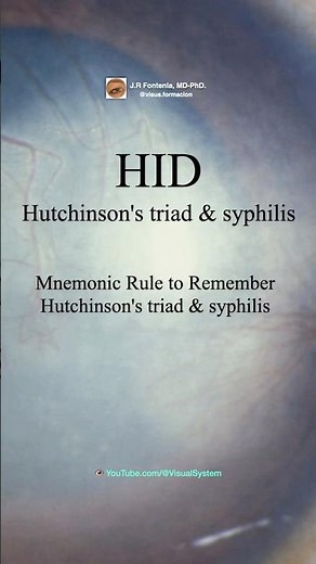 Hutchinson's Triad & Syphilis. HID: Mnemonic Rule to Remember Hutchinson's Triad & Syphilis.
