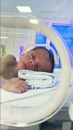 The Brave Fight of Premature Babies 👶💖 | Preemie Survival & Care Tips