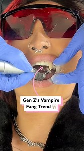 916K views · 2.1K reactions | Paid $500 for vampire teeth 醴 | Four Nine | Facebook