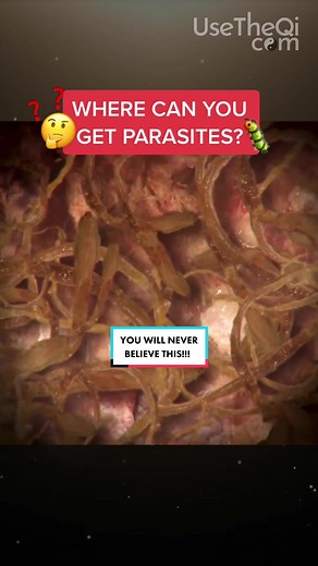 Identifying Toxocara Canis Skin Lesions and Parasites: Health Facts