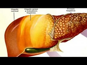 Exhibiting Symptoms Fatty liver