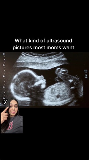 Funny Baby Ultrasound Meme Compilation