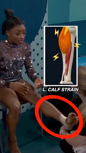 #OlympicGymnastics 🐐 #SimoneBiles suffered a re-aggravation of a left calf injury today while warming up for her floor routine, let’s break this down. #Medspiration...#simonebiles🇺🇸 #olympic #gymnastics #summerolympics #parisolympics #olympics2024 #womensgymnastics #biles #gymnast #sportsmedicine #calf | MEDspiration