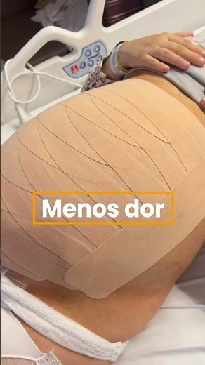 Taping pós parto Normal ou cesárea!aplicado nas primeiras 48h após o parto. WhatsApp 11 91331-8023