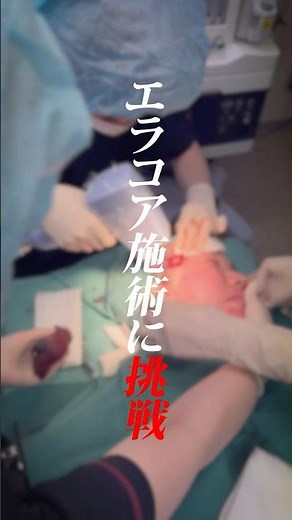「最新のたるみ治療って、実際どうなの？」と気になっていませんか？#エラコア #城本クリニック #たるみ改善 #切らないたるみ治療 #美容外科医