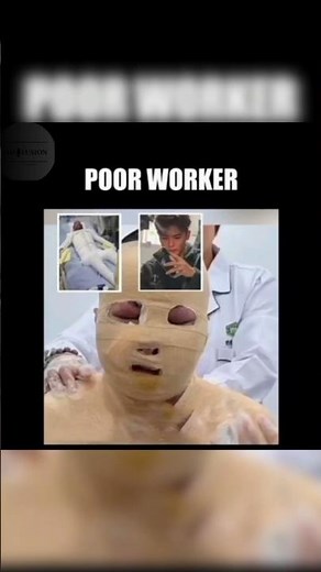 Poor Worker Fell in 800°C Boiling Water in china 😨 | Shocking Incident || #chinanews #chinafacts