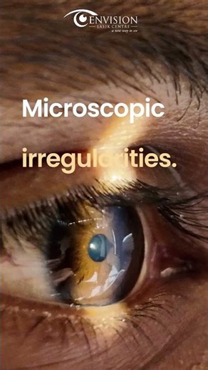 What Doctors Actually Sees 👁️ | Hyderabad, #envisionlasikcentre #dradvaith