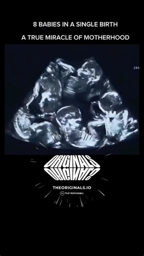MEDICAL | HEALTH | BIOLOGY | 8 babies in one single birth — a true miracle of motherhood. This extremely rare event is known as octuplet birth, where a mother delivers... | Instagram