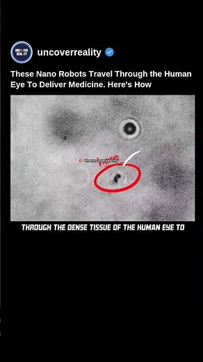 These Tiny Robots Travel Through the Human Eye to Deliver Medicine 🤯 #robot #shorts #tech #medical