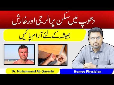How to Treat Sunlight Skin Allergy & Itching Fast | Best Home Remedies That Work