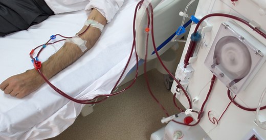 New type of heart disease identified links obesity, diabetes and kidney disease