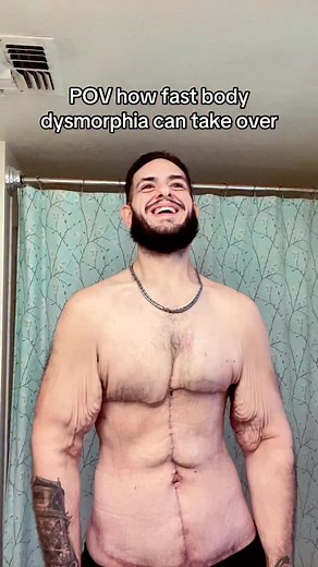 84K views · 4K reactions | It literally takes almost nothing sometimes to trigger the whole thing over again. | Garrettolsonweightloss | Facebook