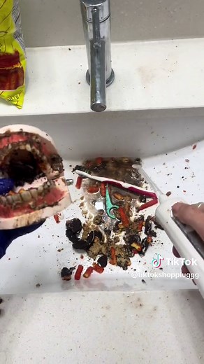 Affordable Water Flosser for Dental Health