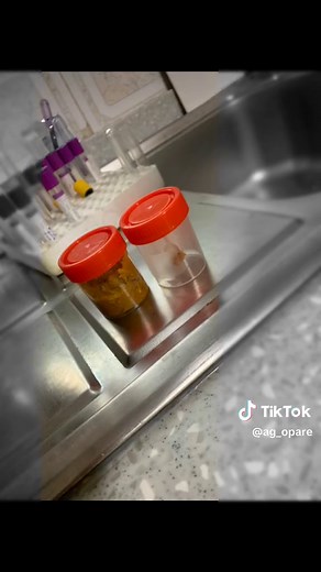 The Ultimate Guide to Collecting Stool Samples for Medical Laboratory Testing