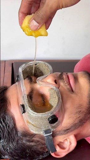 Netra Basti For Eye Care | #panchkarma #eyecare