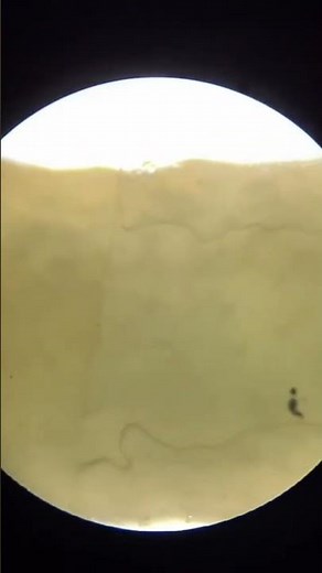 Exploring Noodles Under the Microscope 🔬 | Close-Up View