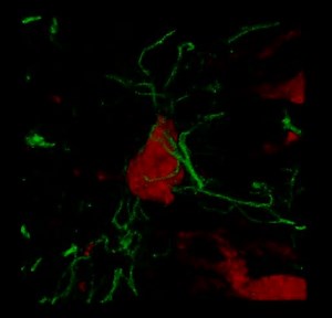 File:The-Neuron-Astrocyte-Microglia-Triad-in-Normal-Brain-Ageing-and-in-a-Model-of-Neuroinflammation-in-pone.0045250.s001.ogv - Wikimedia Commons
