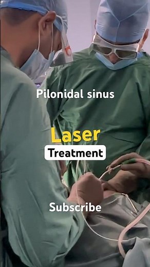 How LASER treatment for Pilonidal Sinus surgery ? Steps for operation ?