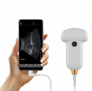 [Hot Item] Vet Equipment Portable Type C Veterinary Ultrasound Scanner for Android