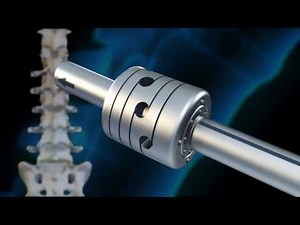 Paradigm Spine - HPS 05 Rod & Coupler Features