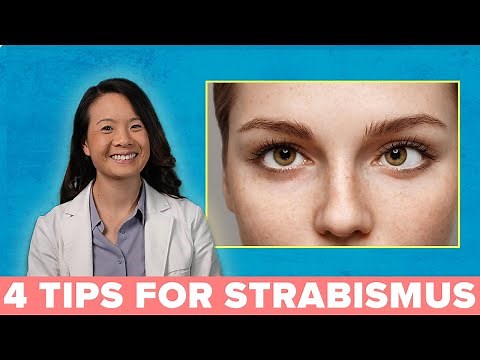 4 Great Ways to Treat Your Strabismus