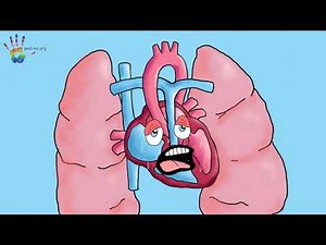 What is a Patent Ductus Arteriosus or PDA?