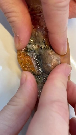 Button batteries honey 🍯 #fyp #babyfirstaid #parenting