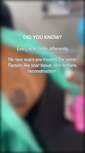 Did You Know Every Scar Heals Differently? #shorts #tattoo