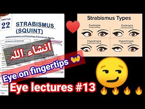 Eye lectures #13. #Strabismus. #Squient. exotropia entropia #hypertropia #hypotropia #eye