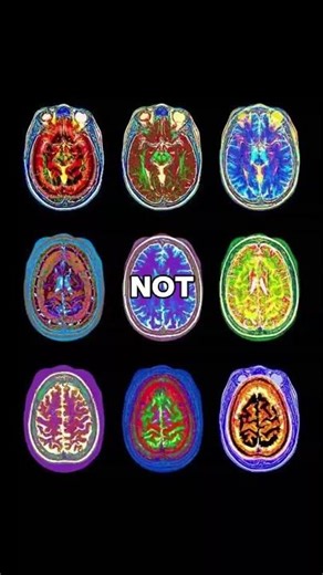 You dont smoke because you want to... your brain was Trained to 🧠🚬