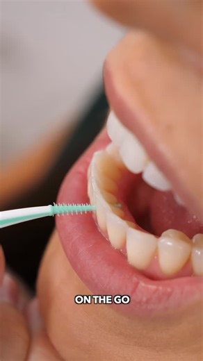 Whitney DiFoggio on Instagram: "#ad Stop using toothpicks! Soft-picks are so much better. Specifically, GUM® Soft-Picks® Advanced have soft flexible bristles that slide easily between teeth, removing 22% more plaque* than brushing alone, and they’re the #1 Dental Pick brand**. They’re comfortable, effective, and fit right in your bag so you can use them anytime, anywhere. Dental hygienist approved supporting both oral AND whole body health. A Healthy Body Needs GUM™. @gumoralcare (*DOF-0065, **D