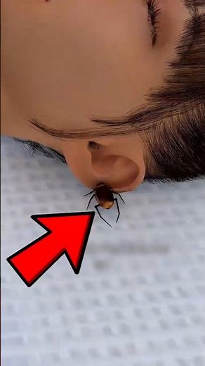 If a Cockroach Enters Your Ear… DON’T Do This (Most People Make It Worse)