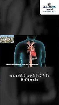 LVAD: A Lifeline for Heart Failure Patients