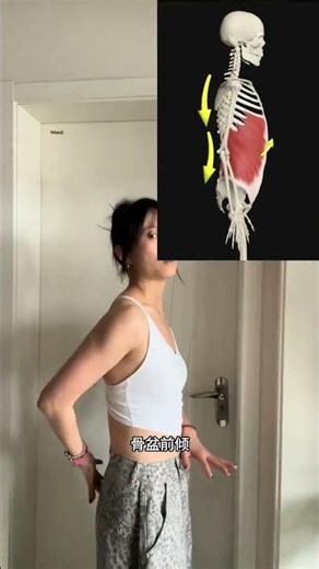 Straighten Up! The Ultimate Guide to Fixing Your Slouched Shoulder Blades