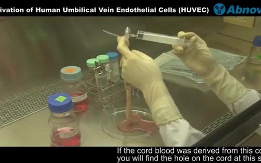 人脐静脉内皮细胞提取Der ivation of Human Umbilical Vein Endothelial Cells (HUVEC)